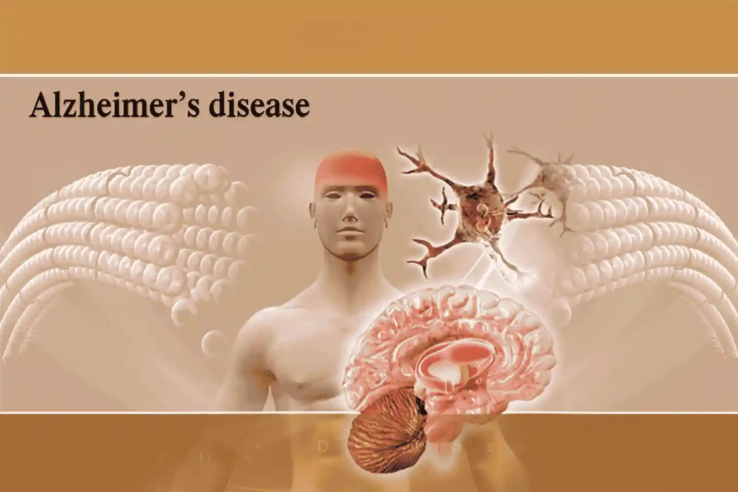 Alzheimer’s Disease